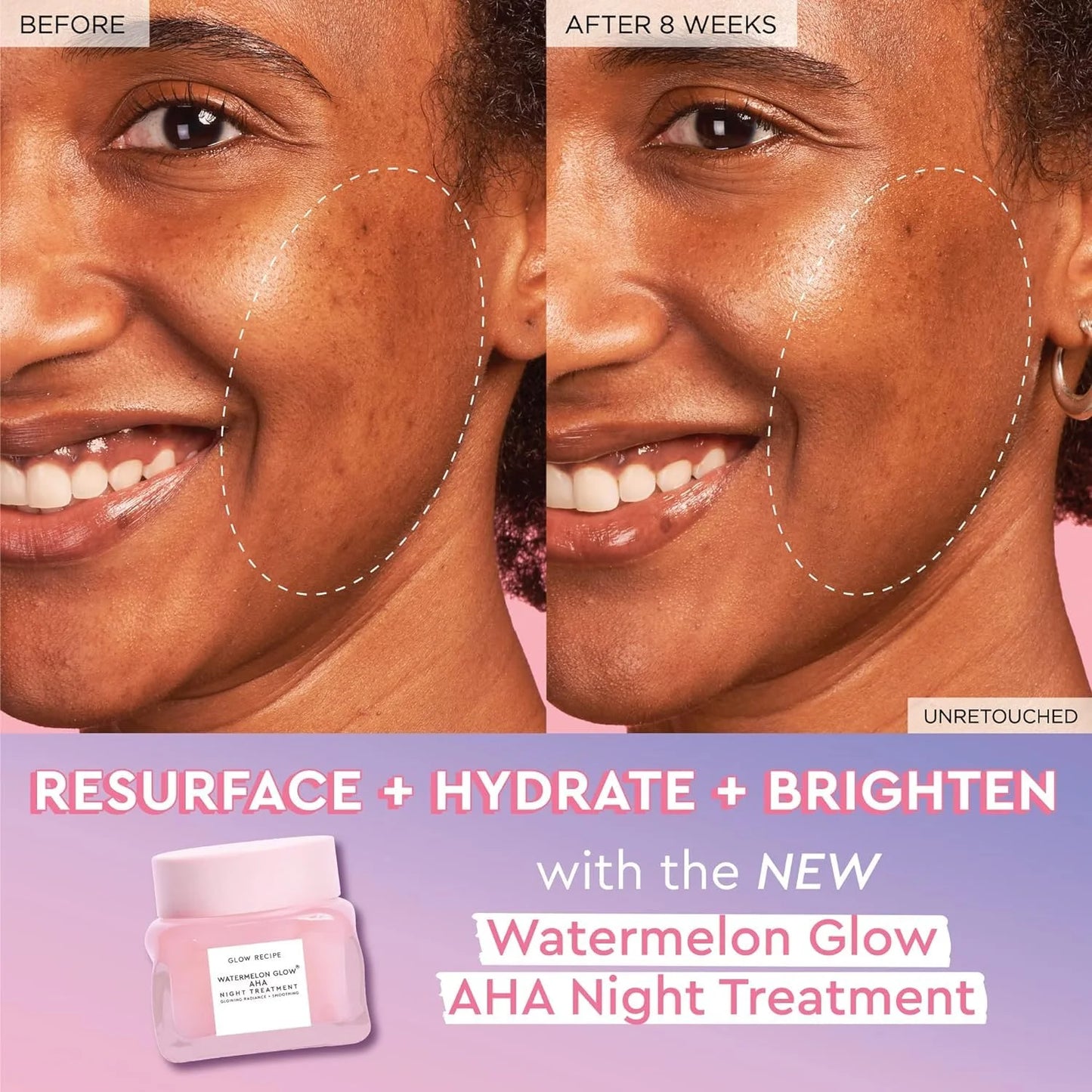 Watermelon Glow AHA Night Mask – Overnight Resurfacing Treatment for Smooth & Radiant Skin (60ml)